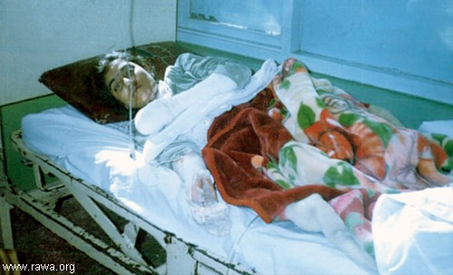 Muska, an election worker who burnt herself after a rape attempt on her by a UN local driver