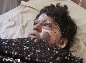 Self-immolation in Qandahar