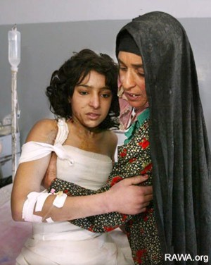 Self-immolation on raise among Afghan women