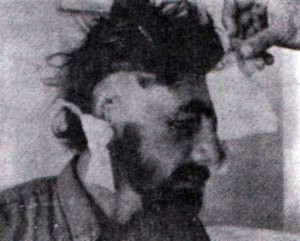 Injured man