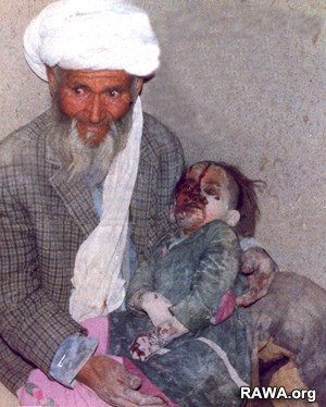قربانی بمباردمان روسها