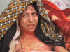 One of tens of self-burning victims in Afghanistan